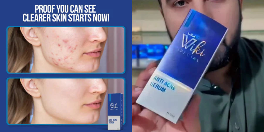 Wiki Special Serum(Clean Your Face)